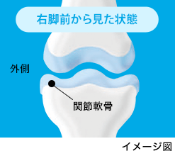 正常な関節