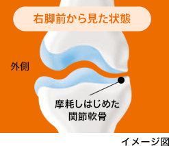 初期