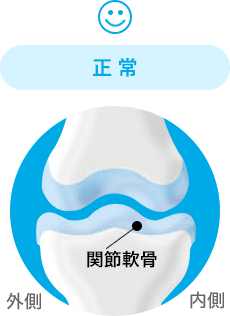 正常