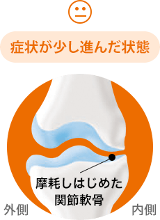 正常