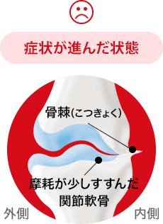 正常