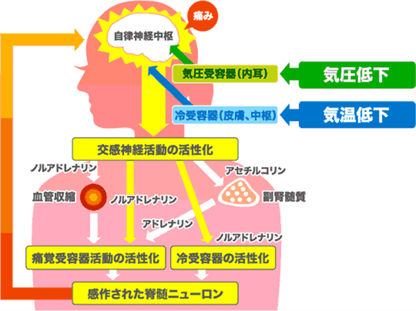 天気痛のメカニズム図