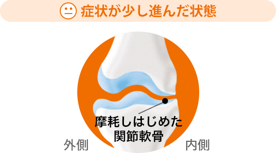 症状が少し進んだ状態
