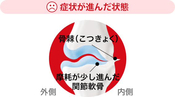 症状が進んだ状態