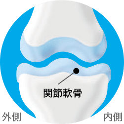 正常