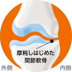症状が少し進んだ状態