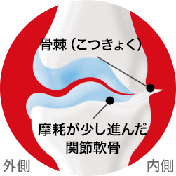 症状が進んだ状態